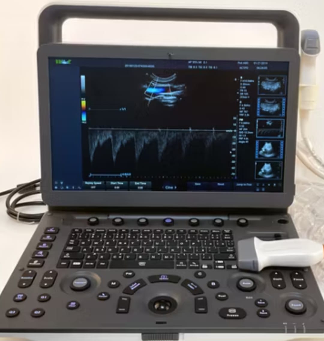 Ecógrafo Portátil Doppler Color 4D MSLCU77