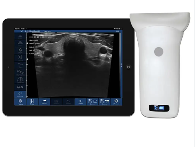 Eco Doppler Inalámbrico MSLPU80